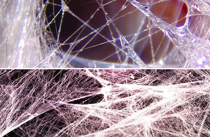 fascia