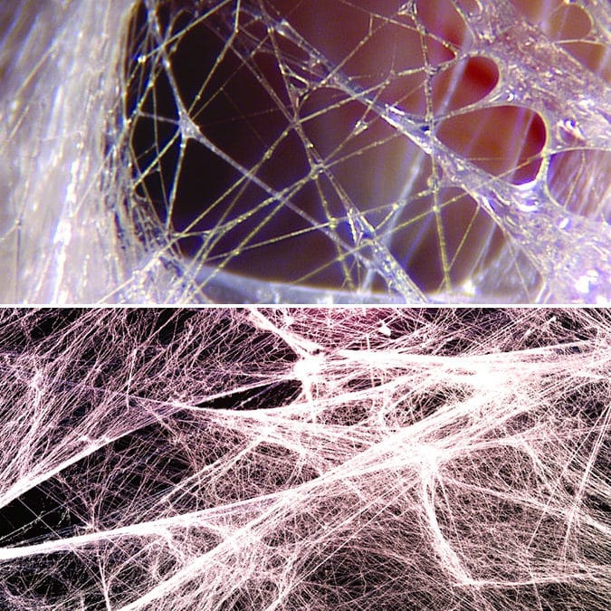 fascia